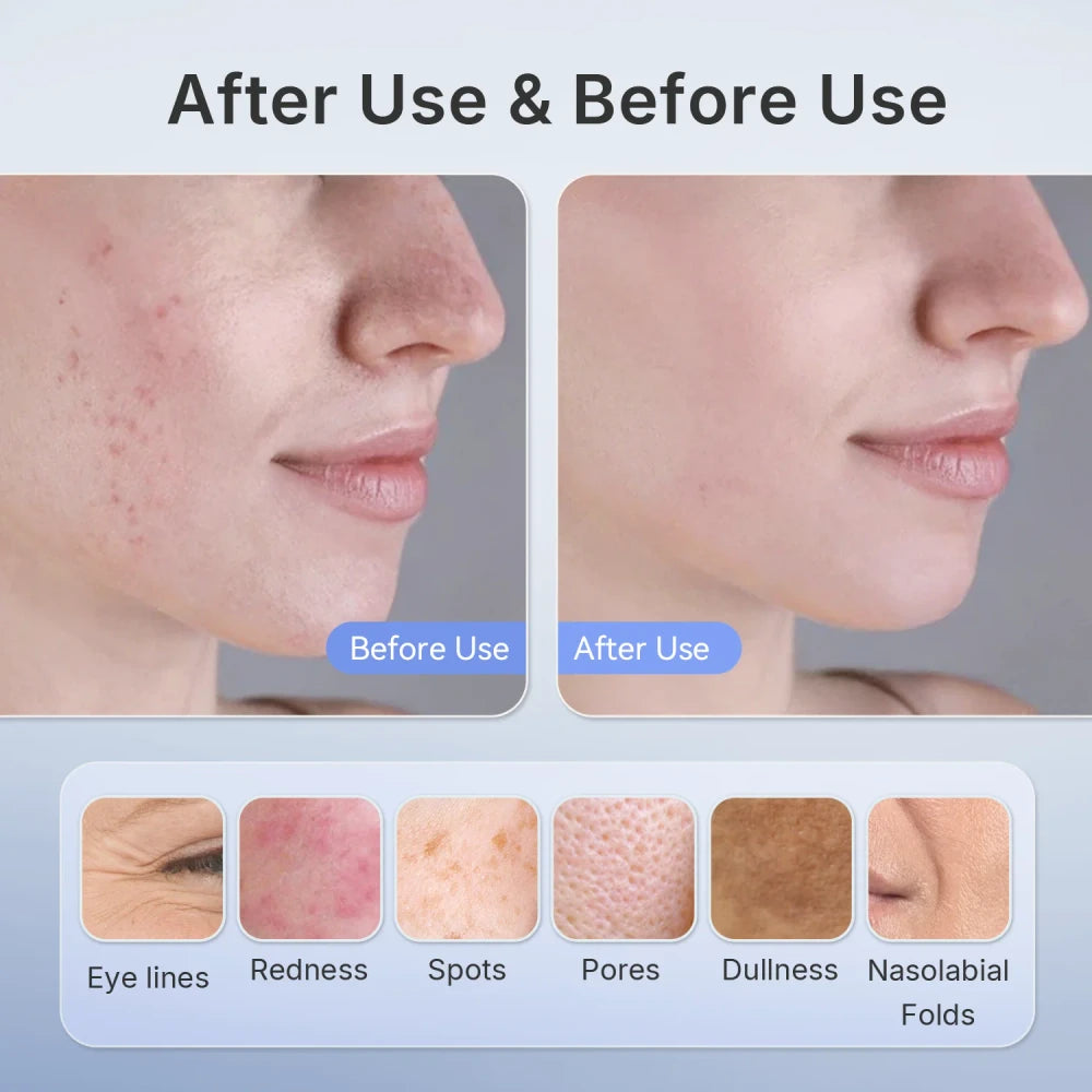 Hello Face Wireless Red Light Therapy Facial Mask